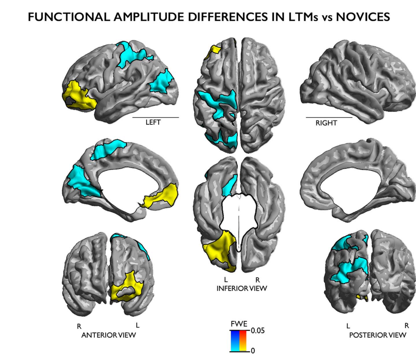 Brain surface renderings from multiple views showing clusters of increased (yellow) and decreased (cyan) functional amplitude in long-term meditators versus novices during lovingkindness meditation, concentrated in left frontopolar, orbitofrontal, and parietal regions.