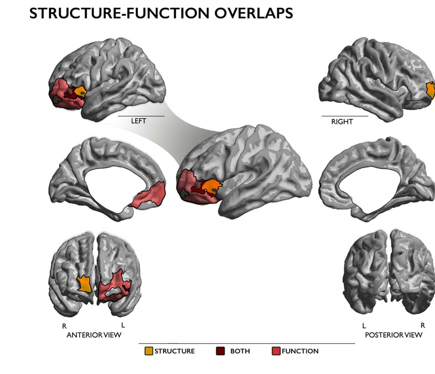 Brain surface renderings showing overlap between structural (orange) and functional (red) differences in long-term meditators versus novices, with overlap (dark red) concentrated in left ventrolateral prefrontal cortex.