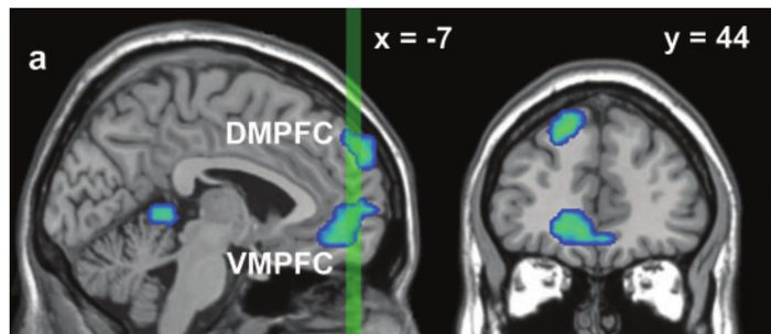 fMRI slices: ventromedial and dorsomedial prefrontal cortex, shown in blue, activated more for narrative than experiential focus.