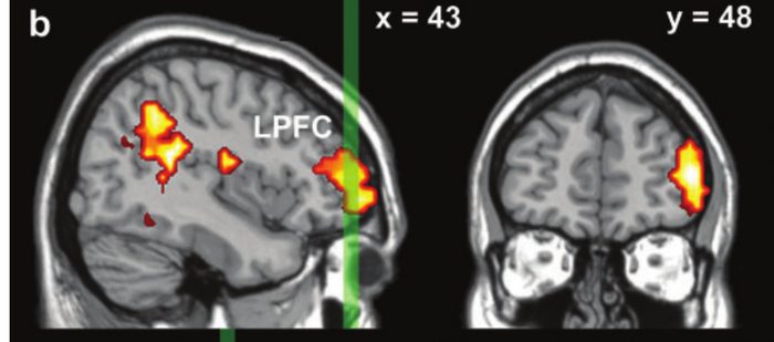 fMRI slices: right lateral prefrontal cortex, shown in red/orange, activated more for experiential than narrative focus.