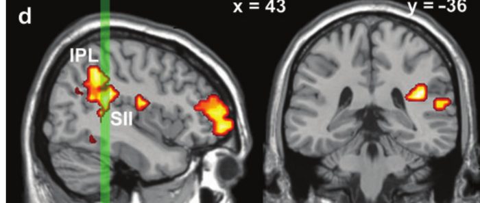 fMRI slices: right secondary somatosensory cortex and inferior parietal lobule, shown in red/orange, activated more for experiential than narrative focus.