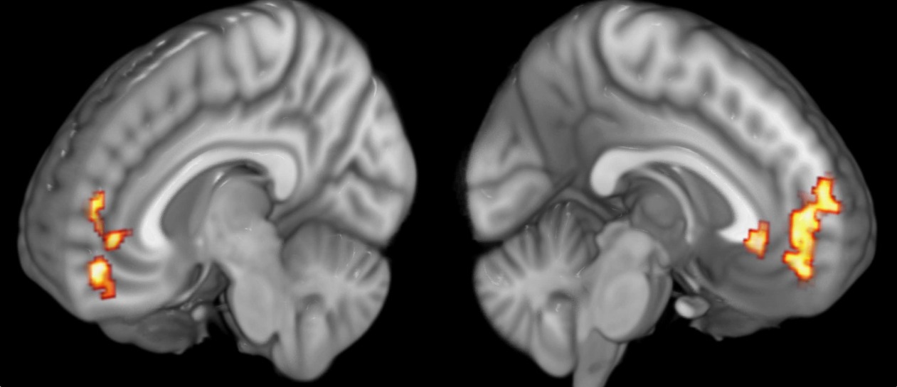 Sagittal fMRI slices of both brain hemispheres showing medial prefrontal cortex activity correlated with participants' gratitude ratings.