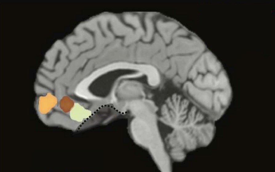 Sagittal fMRI slice showing the anterior, central, and ventral VMPFC regions of interest, color-coded in orange, brown, and green.